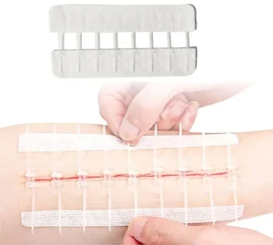 1 Row 3 Rows 10 Rows First Aid Transparent Wound Dressings Suture Free Zip Lock Stitches Medical Zip Stitch Closure