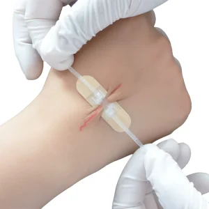 1.2cmx5.5cm Medical Disposable Sterile Adhesive Skin Wound Closure Zip Wound Strip Wound Closure Device