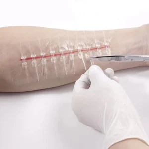 10 Buttons PU Film Medical Wound Closure Zipper for Surgical Traumatic Cesarean Incisions