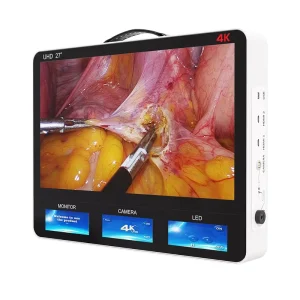 27 Inch Portable Full HD 4K Medical Endoscope Camera System for ENT Laparoscopic Hysteroscopy Surgery