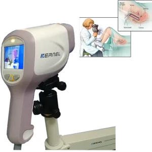 30X HD Video Colposcope KN 2200I(H) Digital Colposcope for Gynecology 3.27MP Pixels Multifunction Software