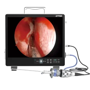 9115H All in One FHD Electric ENT Endoscope System Metal Construction IPX8 Waterproof 15″ Display for Ear Otolaryngology