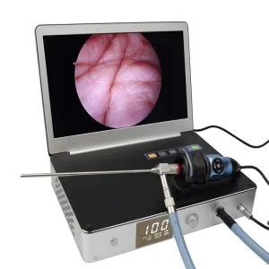 All in One Medical Endoscopic Camera Endoscopy System for Hospital Use