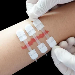 CE Zip Reinforced Magic Stitchless Wound Closure Device Topical Sterile Adhesive Strips Medical Tape Skin Stapler