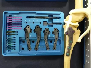 Canine Tibial Plateau Leveling Osteotomy Surgical Instrument TPLO Locking Plate System