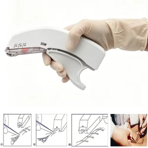 Chirurgische Incisie Hechtdraad Huid Nietmachine 35W Steriele Intraoperative Wound Management Wegwerp Postoperatieve Nietmachine