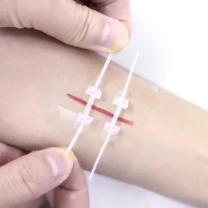 Custom Disposable Ventilate Transparent Bandage PU Film Zipper Closure Wound Zipper Closure Device For Children And Adult