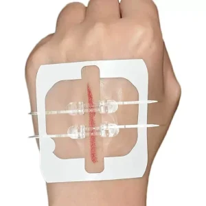 Custom Trummed Transparent PU Film Zipper Closure Wound Zipper Closure for Laceration