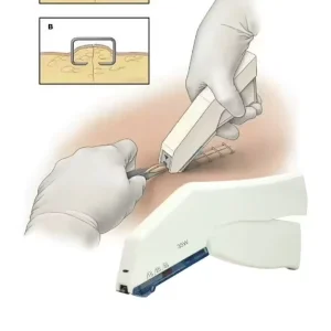 Disposable Skin Stapler 35W and Remover Sterile Stapler for Medical Surgery