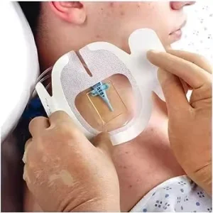 Disposable Sterile Waterproof CHG Chlorhexidine Gluconate I.V. Securement Dressing