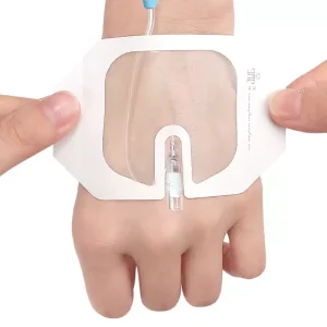 Disposable Transparent Medical PU Transparent Film Dressing Wound Dressing Waterproof IV Fixation Adhesive Patch