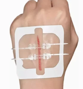 Disposable Zipper Suture Wound Closure Device Elastic Zipper Bandage Medical Scar Patch