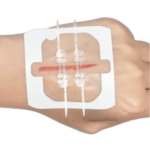 Disposable Zipstitch Zip Non invasive Wound Closure Device Without Stitches