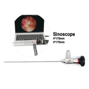 ENT Sinoscope 2.7mm Rigid Endoscope 3.0mm Endoscope Nose for ENT Surgery Lens ENT 4.0mm Rigid Nasal Endoscope