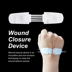 EO Sterilized Emergency Strips Zip Stitch Wound Closure Device Self adhesive Zipper Suture Wound Care Device