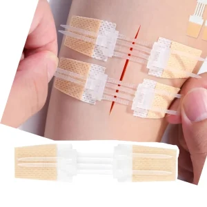 Effective Wound Skin Closure Steri Strips Device Zip Tie Butterfly Tape Band Aids for Cuts