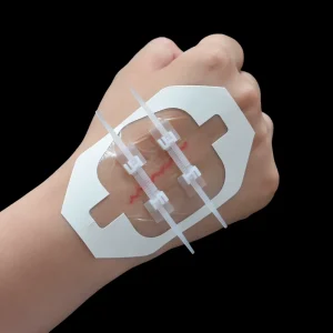 Elastic PU Film Zip Tie Wound Closure Device Emergency Steri Strips for Wound Closure