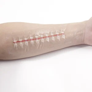 Elastic Pu Film Zip Tie Wound Closure Device for Emergency Wound Closure Advanced Wound Dressing