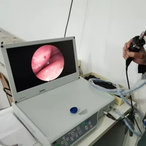 Electric Power Source Medical Endoscope Laparoscopy Camera Surgical Instruments Basis