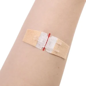 Emergency Laceration Closures Medical First Aid Supplies Butterfly Bandage Wound Care Surgical Sutures Strips