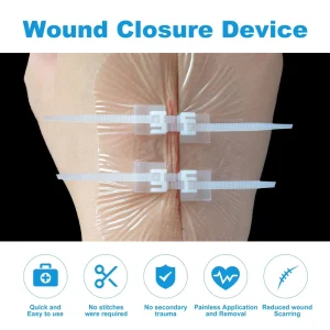 Emergency Painless Zip Sterile Strips Transparent Self adhesive Wound Closure Device for Skin Dressing