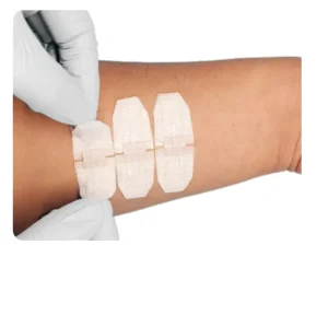 Emergency Wound Closure Device Zip Stitch Wound Closure Device