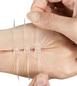 Emergency Wound Closure Devices Zipper Wound Closure Strips Laceration Closure Kits