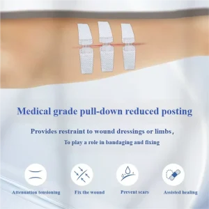 Emergency Wound Closures Zipper Band Painless Adjustable Individually Wrapped & High Adhesion Fit for First Aid Wound Care