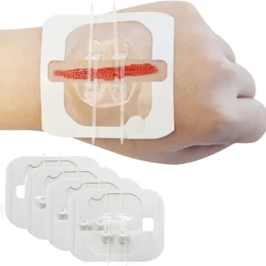 Emergency Zip Stitch Wound Closure Device Stitch Free Waterproof Adhesive Skin Closure Strip Painless CE Certified 6*7cm