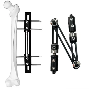 External Fixation Device Orthopedic Surgical Instruments Knee Joint External Fixator Orthopedic Surgical Fixator