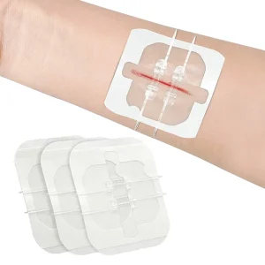 Factory PU Zip Stitch Emergency Trauma Skin Closure Repair First Aid Wound Closures Device Outdoor