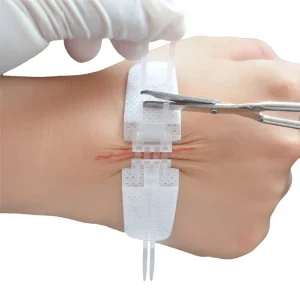 Factory Supply OEM Self Adhesive Wound Dressings EO Sterile Zip Stitch Medical Zipper Closure Device Zipper Wound Closure Strip