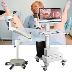Gynecology Medical Colposcopy Instrument Equipment Binocular Optical Colposcope Camera 2.1 Million Effective Pixels