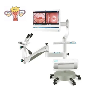 HD Integrated Colposcope Microscope Medical Gynecology Vaginal Diagnosis Video Optical Colposcope