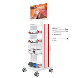HD Laparoscopic Surgery Laparoscopy Tower 0 30 Degree Manual Power Source Medical Equipment