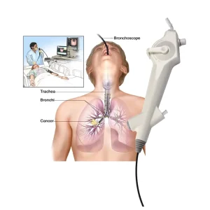 Haiye Disposable Electronic Nasopharyngo Laryngoscope Flexional Design Clear Imaging for ENT Examination and Clinical Diagnosis