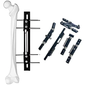 High Quality Bone Lengthening Stainless Steel Orthopedic External Fixation Femur Tibial Fixator the Basis Surgical Instruments