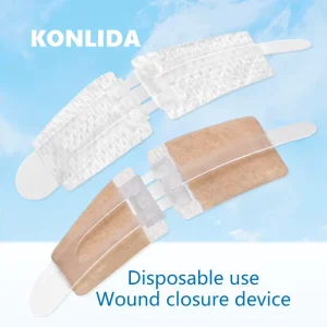 High quality Wound Closure Strips Device Stitch Zip Closured Wound for Wound Care
