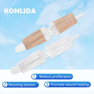 Hospital Surgical Sterile EO Disinfecting Class II Wound Closure Strips Steri Strip Tape for Skin Closure