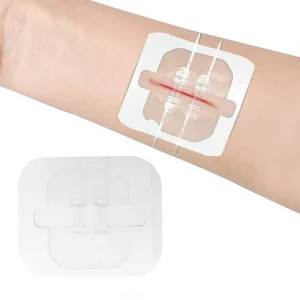 Laceration Trauma Skin Closure Repair Disposable Zip Sutures Emergency Care Wound Closures Device