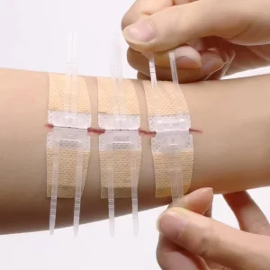 Laceration Wound Closure Device Emergency Laceration Closure Strips to Repair