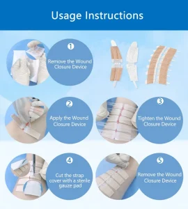 Medical Disposable Skin Wound Closure Device Zip Stitch Dressing