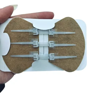 Medical Disposable Sterile Zip Stitch Wound Closure Device with Zipper Wound Closures Strip