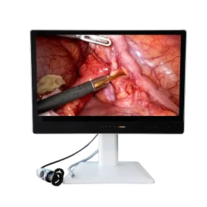 Medical Electric 4K Endoscopic Camera System for Laparoscopy and Orthopedic Surgery