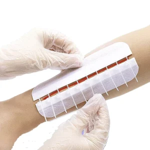 Medical Grade PU Skin Closures Reusable Adhesive Wound Closure Zipper Non invasive Skin Repair Device