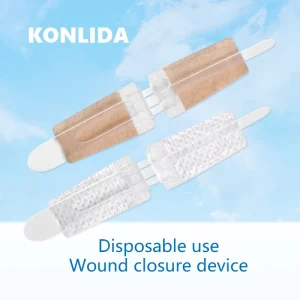 Medical Home Emergency Sterile Wound Closure Device Self adhesive Zipper Suture Wound Care Device
