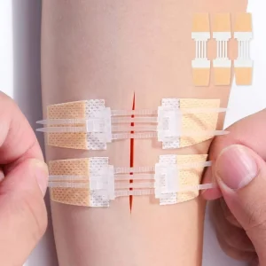 Medical Home Emergency Sterile Wound Closure Device Self adhesive Zipper Suture Wound Care Device
