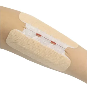 Medical Non Woven Zipper Device for Closing Wounds in South Korea USA Europe Etc