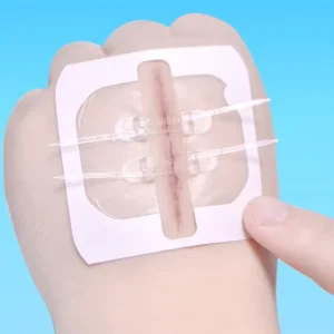 Medical PU Film Tension Reducer PU Film Zipper Type Wound Tape Skin Reduction Tape Suture free Wound Suturing Device