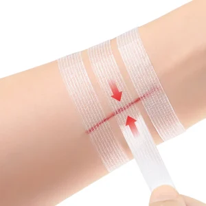 Medical Self Adhesive Surgical Tape Adhesive Wound Skin Closure Strips for Wound Care